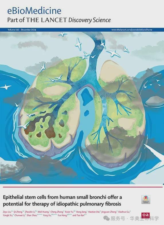 我国科学家重大突破：洪玥教授发表自体干细胞治疗IPF研究成果