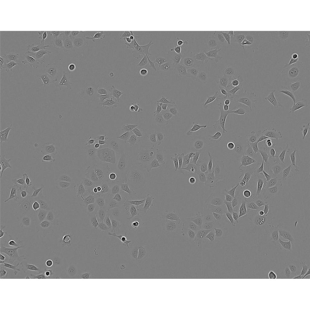 龙虾生猛大厂人惶惶不可终日